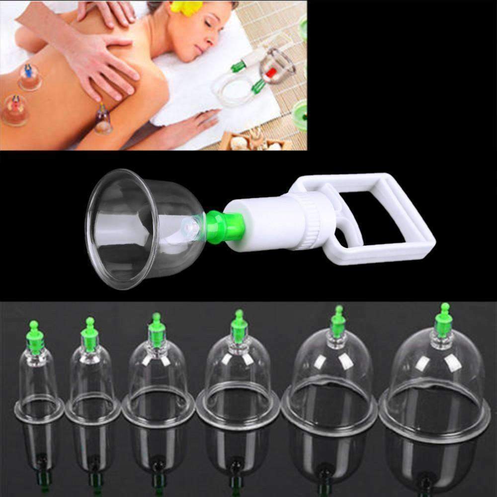 Cupping Therapy Set